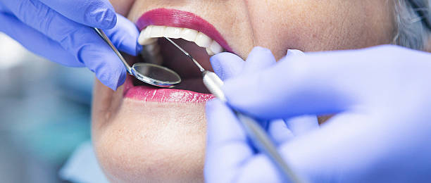 Best Dentist for Tooth Abscess  in Payson, UT