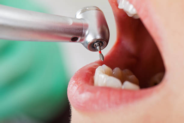 Best Tooth Infection Emergency Dentist  in Payson, UT